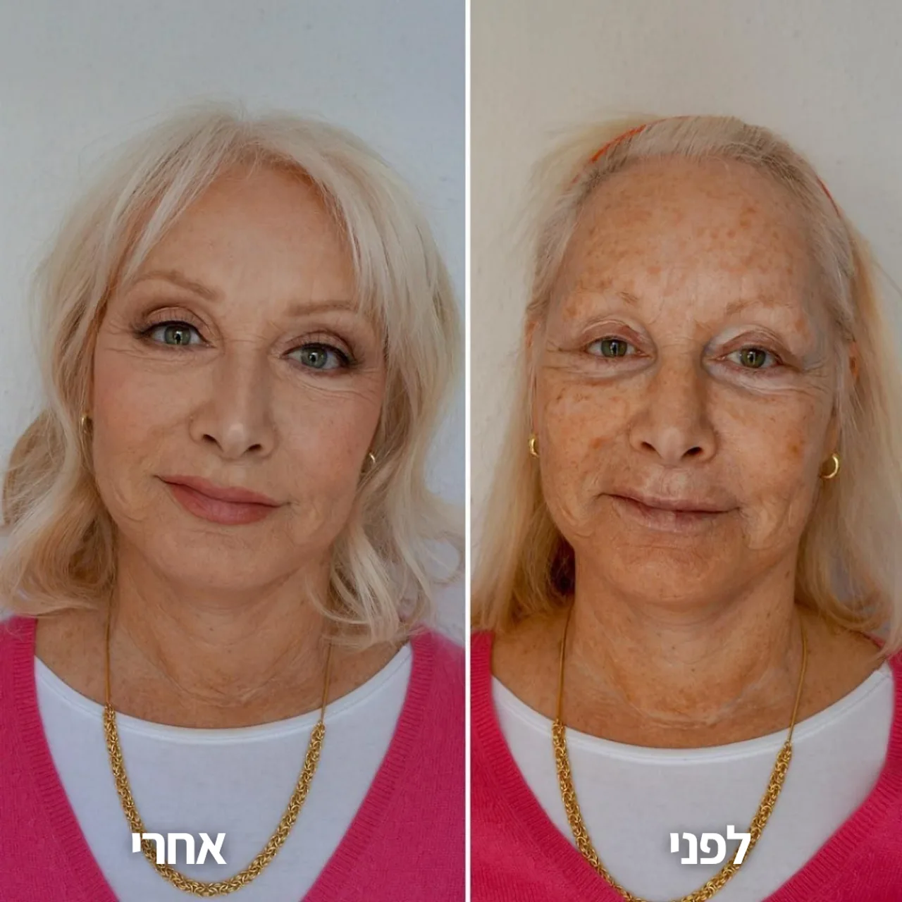 לפני ואחרי — הזוהר חוזר